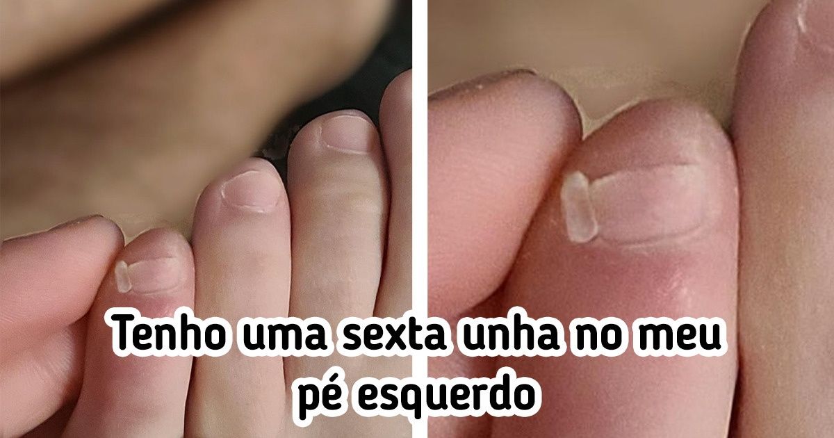 14 Pessoas que ganharam um presente extra da Mãe Natureza 14 Pessoas que ganharam um presente extra da Mãe Natureza