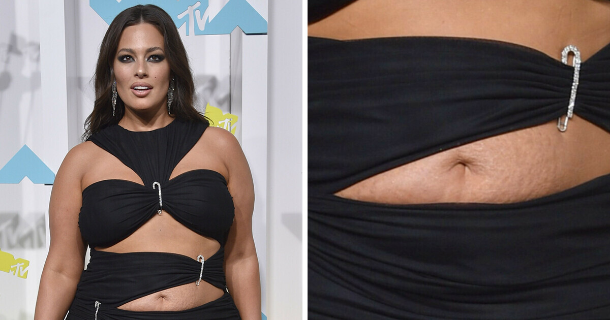 9 Famosas que não escondem suas “imperfeições” e desafiam os padrões de beleza