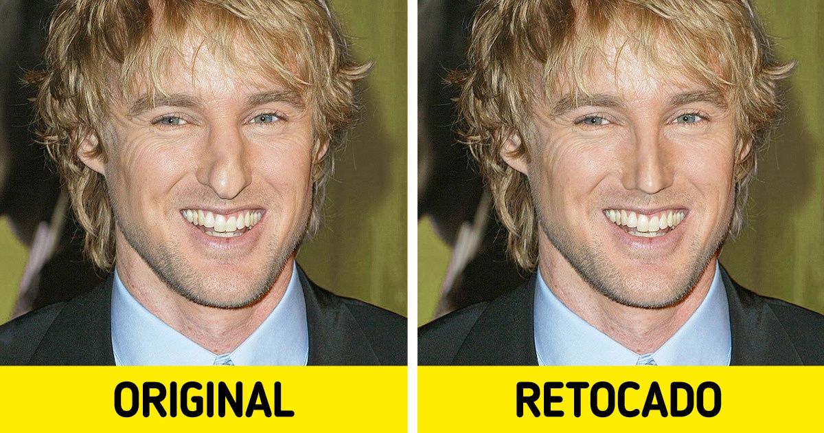 19 Famosos com narizes peculiares mostram que os complexos não levam a lugar algum 19 Famosos com narizes peculiares mostram que os complexos não levam a lugar algum