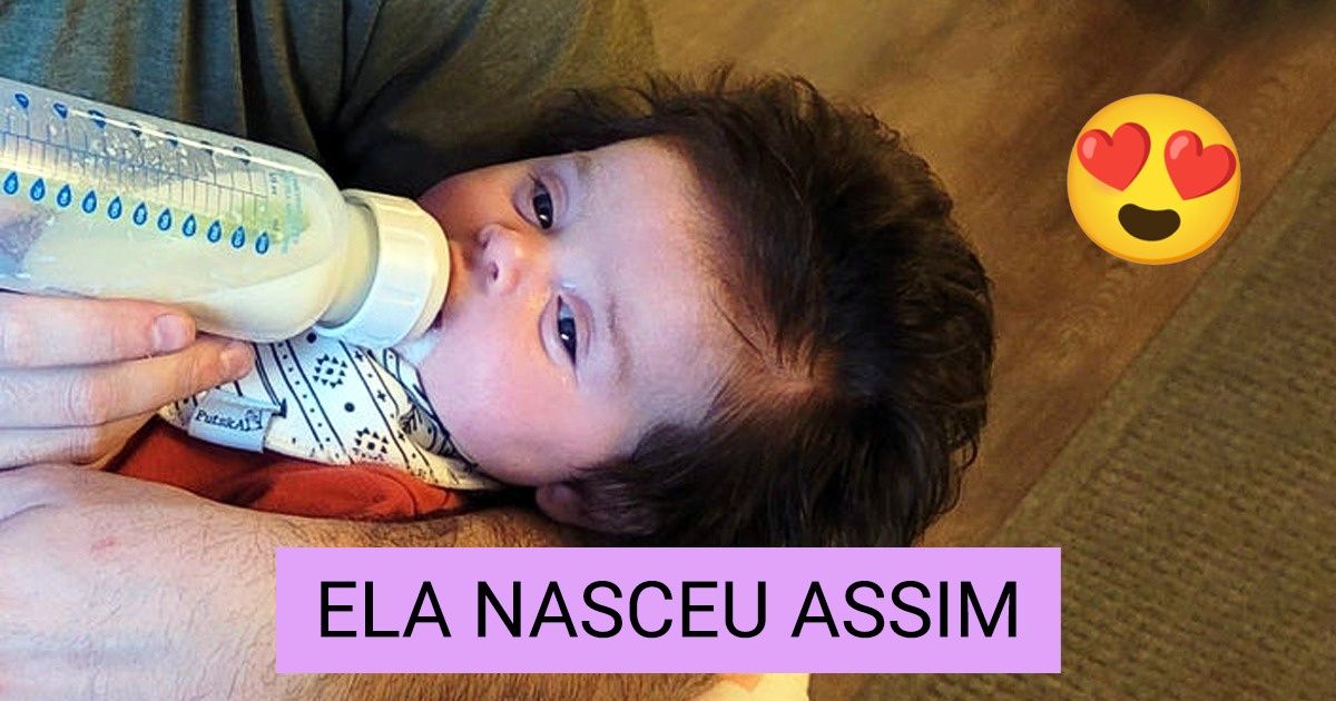 20+ Vezes em que a natureza se mostrou criativa e criou seres com traços únicos — nova seleção 20+ Vezes em que a natureza se mostrou criativa e criou seres com traços únicos — nova seleção