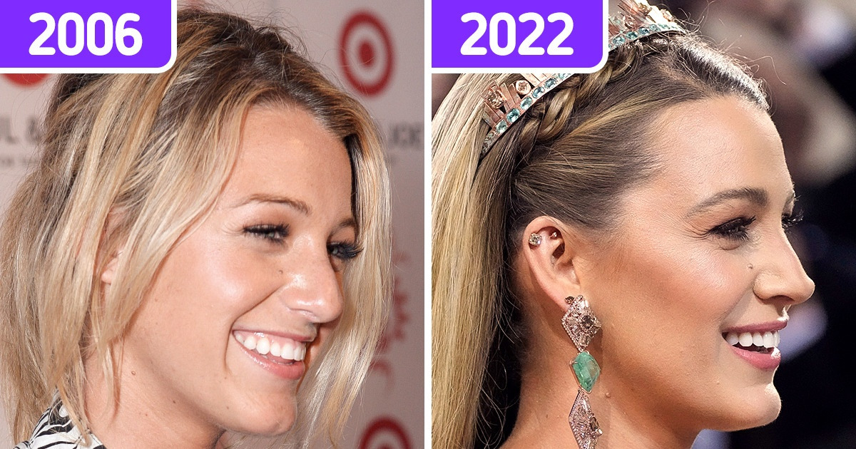 Veja como o tempo e a fama moldaram os rostos destas 11 estrelas