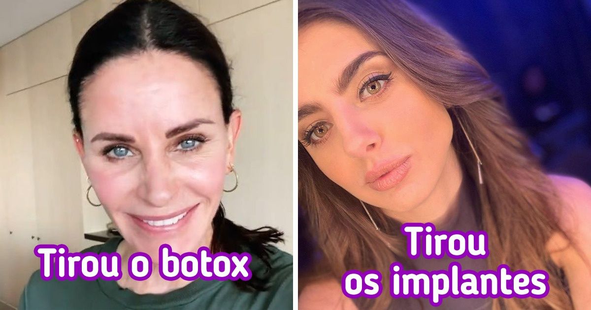 13 Famosas que decidiram remover as cirurgias plásticas e manter a beleza natural 13 Famosas que decidiram remover as cirurgias plásticas e manter a beleza natural