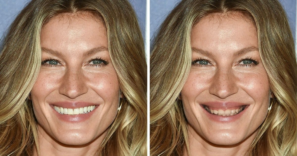 Como seriam estas 18 celebridades caso seus dentes não fossem “perfeitos” Como seriam estas 18 celebridades caso seus dentes não fossem “perfeitos”