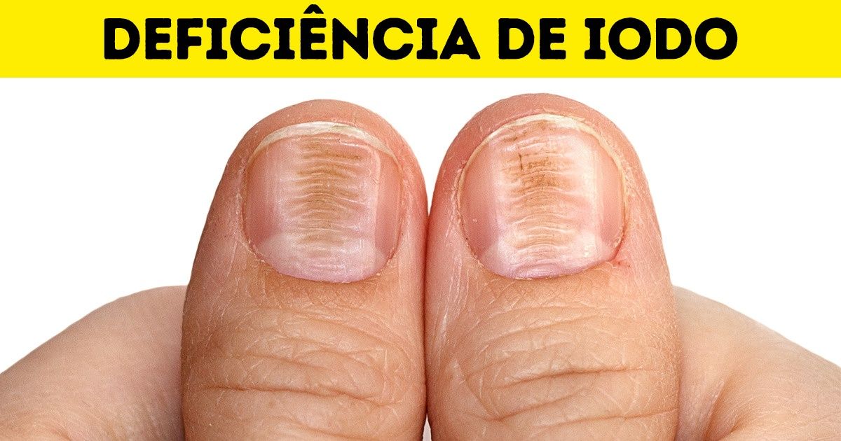 Guia de vitaminas responsáveis por nossa saúde e beleza Guia de vitaminas responsáveis por nossa saúde e beleza
