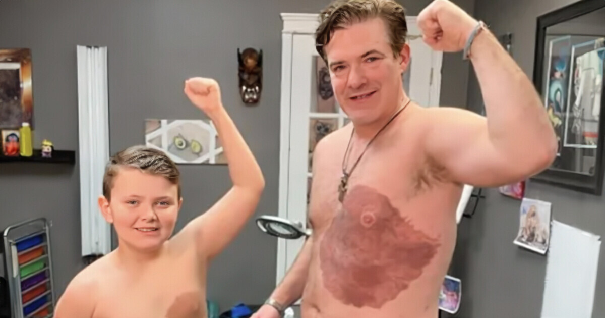 Um pai passou por 30 horas de dor se tatuando para que seu filho pudesse se sentir melhor com sua marca de nascença (fotos) Um pai passou por 30 horas de dor se tatuando para que seu filho pudesse se sentir melhor com sua marca de nascença (fotos)