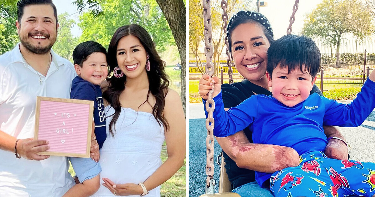 A trágica razão que fez esta mulher ter os braços e pernas amputados após dar à luz