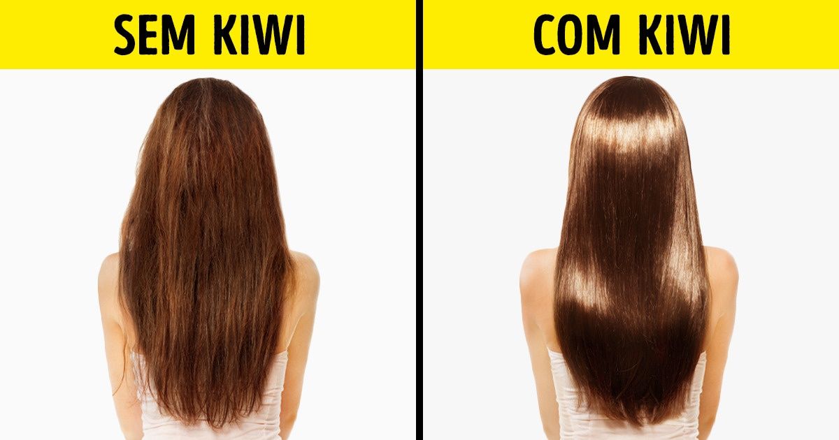 10 Benefícios do hábito de comer kiwi todos os dias para melhorar sua saúde 10 Benefícios do hábito de comer kiwi todos os dias para melhorar sua saúde