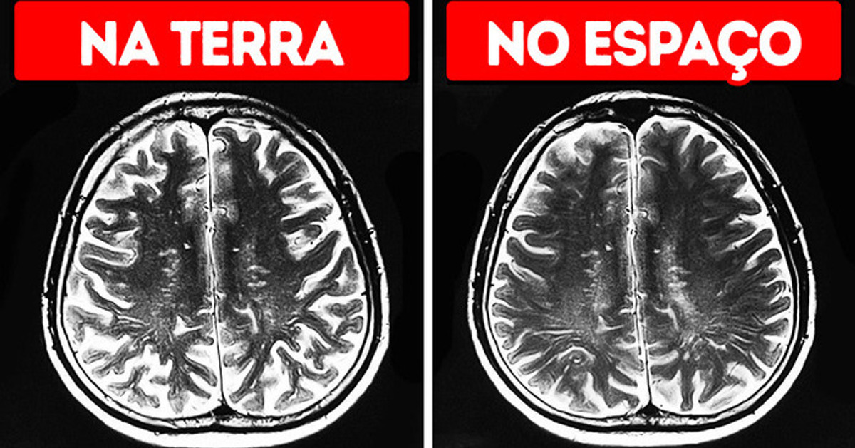 O espaço causa um efeito estranho no cérebro e outros 41 fatos legais sobre o corpo humano