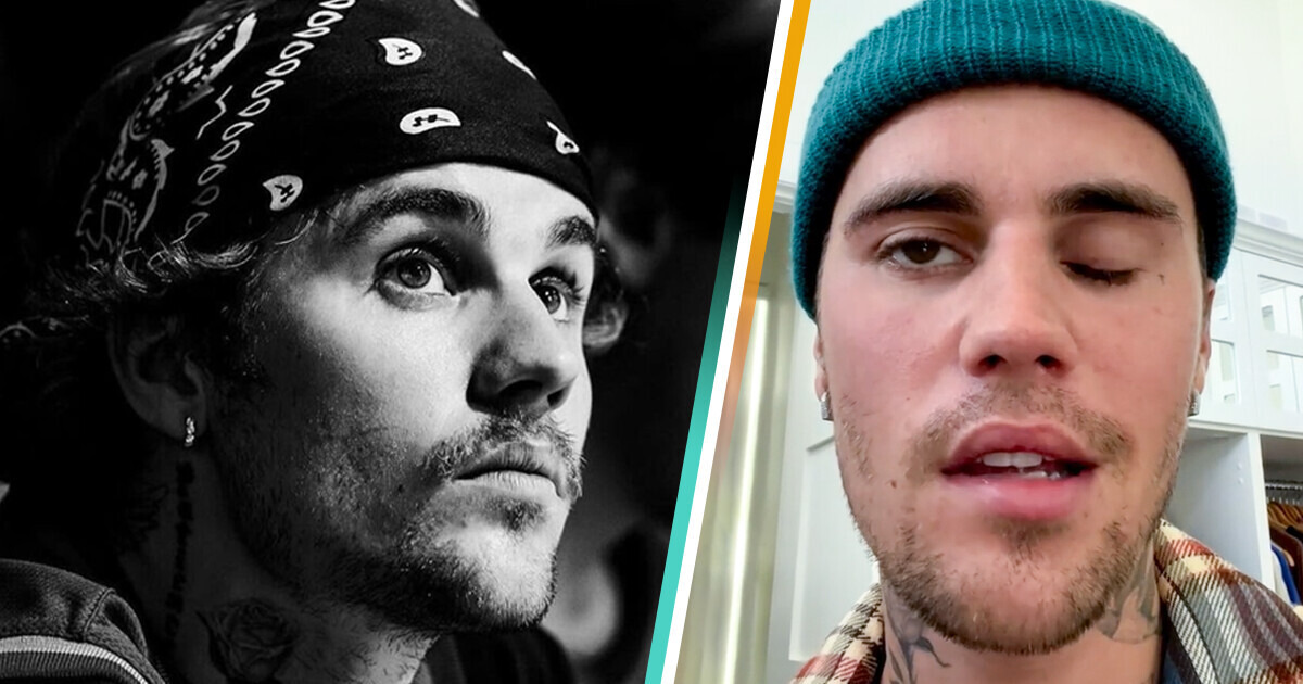 A síndrome que assombra Bieber e seu desabafo sobre os limites diários A síndrome que assombra Bieber e seu desabafo sobre os limites diários
