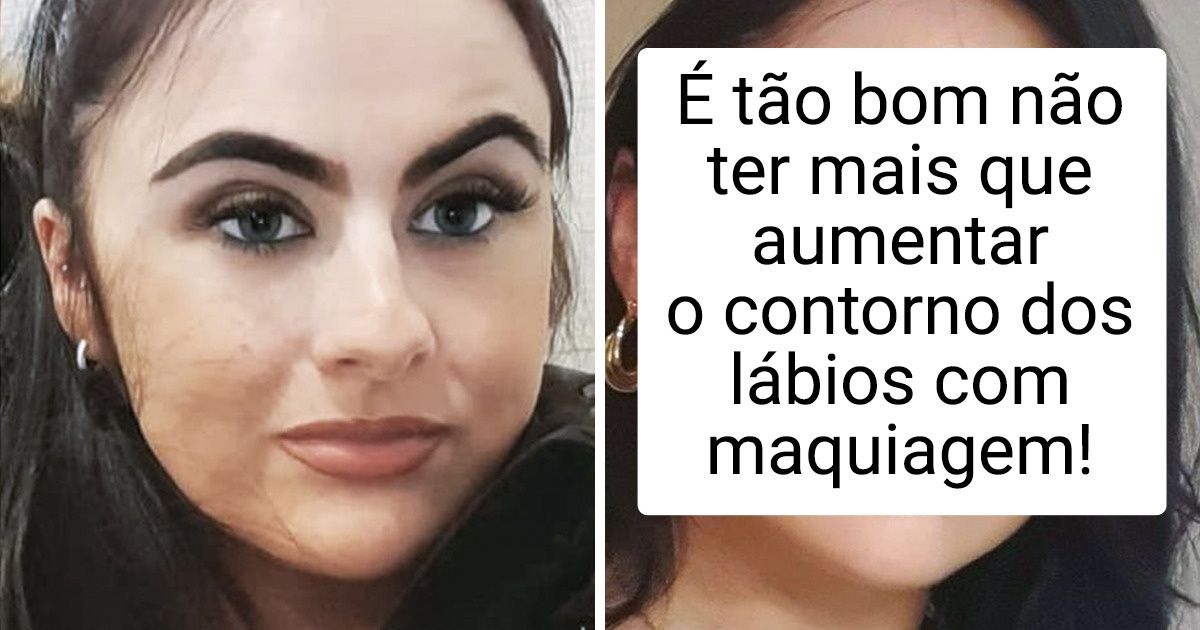 20 Internautas compartilharam fotos do resultado após fazerem cirurgias e procedimentos estéticos