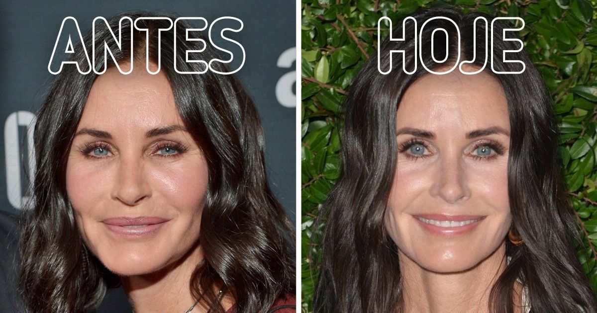 10 Celebridades contam por que disseram “não” às plásticas, incluindo algumas que já se submeteram ao bisturi