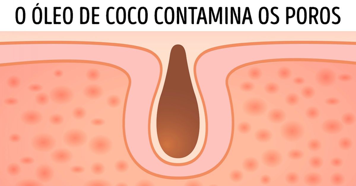 10 Artigos cosméticos com os quais você gasta dinheiro à toa 10 Artigos cosméticos com os quais você gasta dinheiro à toa