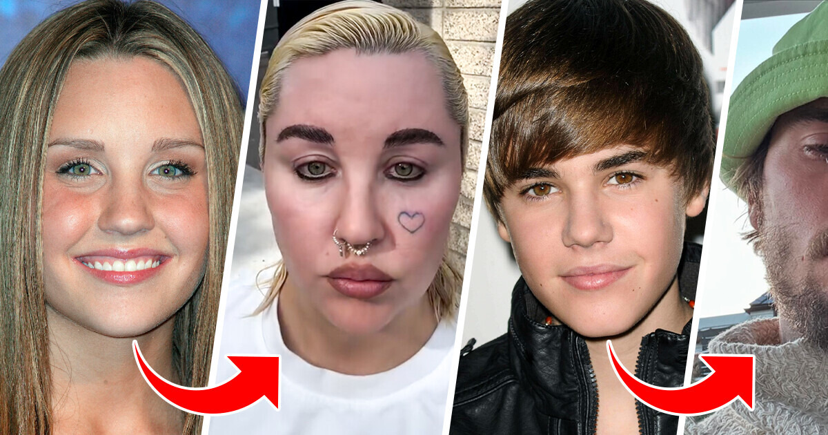 18 Celebridades que se tornaram muito diferentes depois da fama 18 Celebridades que se tornaram muito diferentes depois da fama