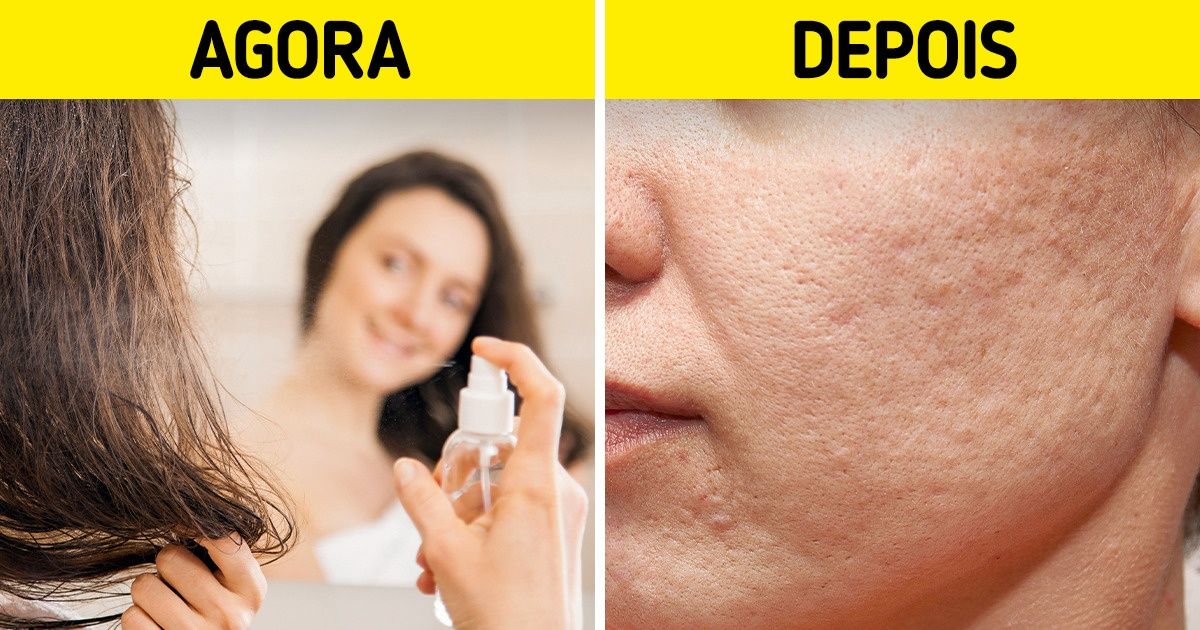 7 Erros no cuidado com a pele que podem resultar em acne