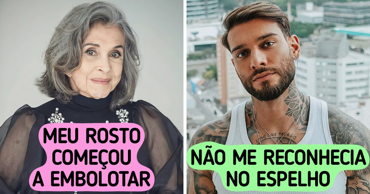 10 Estrelas que confessaram se arrepender de terem feito procedimentos estéticos