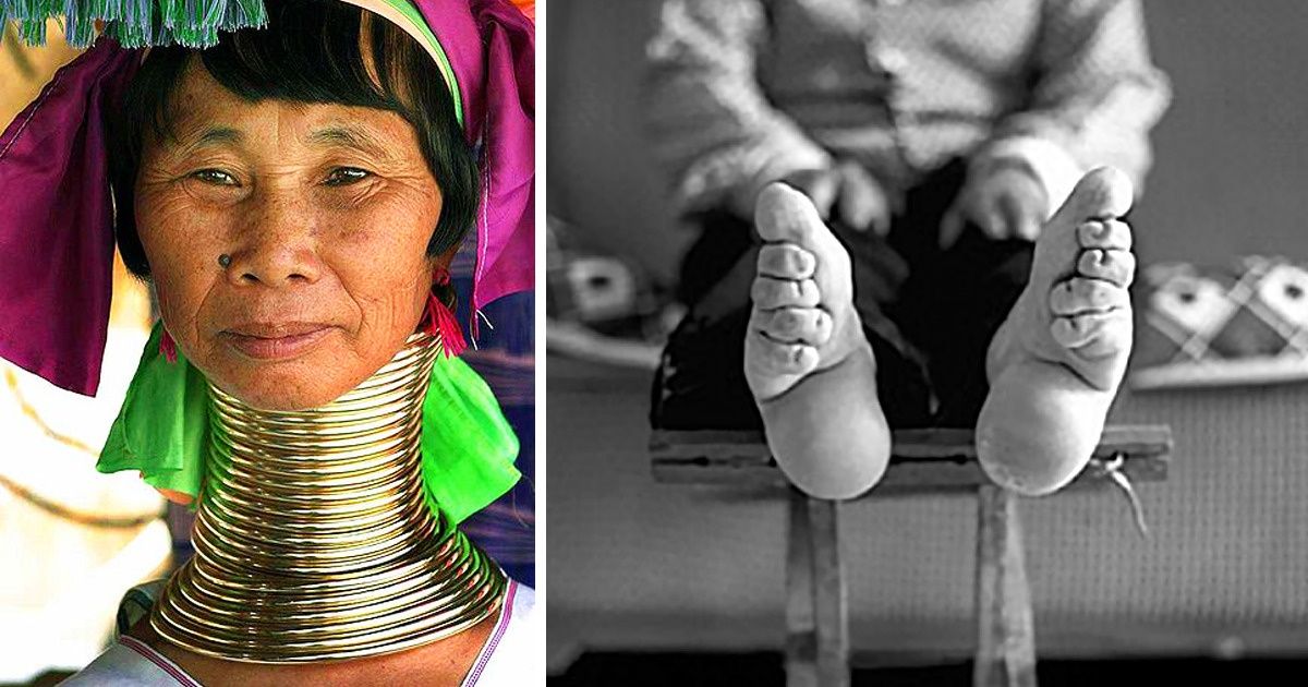 11 Tendências de beleza perigosas adotadas no passado — uma delas até hoje