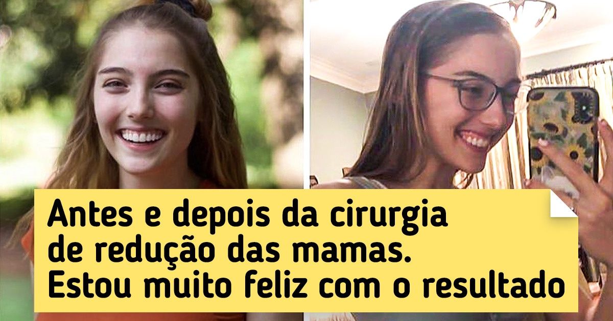 20+ Fotos de “antes e depois” que capturam o progresso em sua forma mais pura 20+ Fotos de “antes e depois” que capturam o progresso em sua forma mais pura