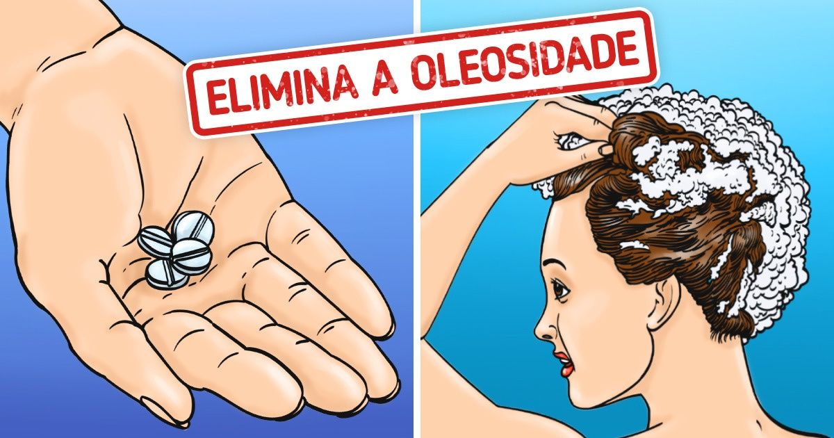 10 Maneiras que podem ajudar a eliminar a caspa sem usar produtos químicos