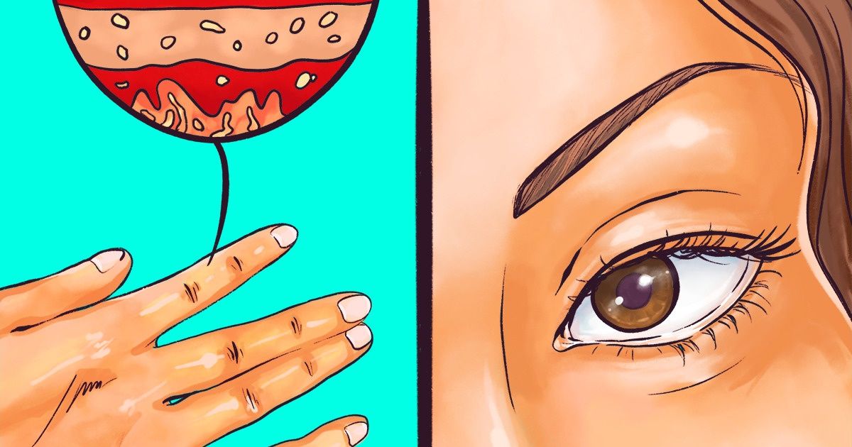 11 Sinais de que sua tireoide não está funcionando corretamente