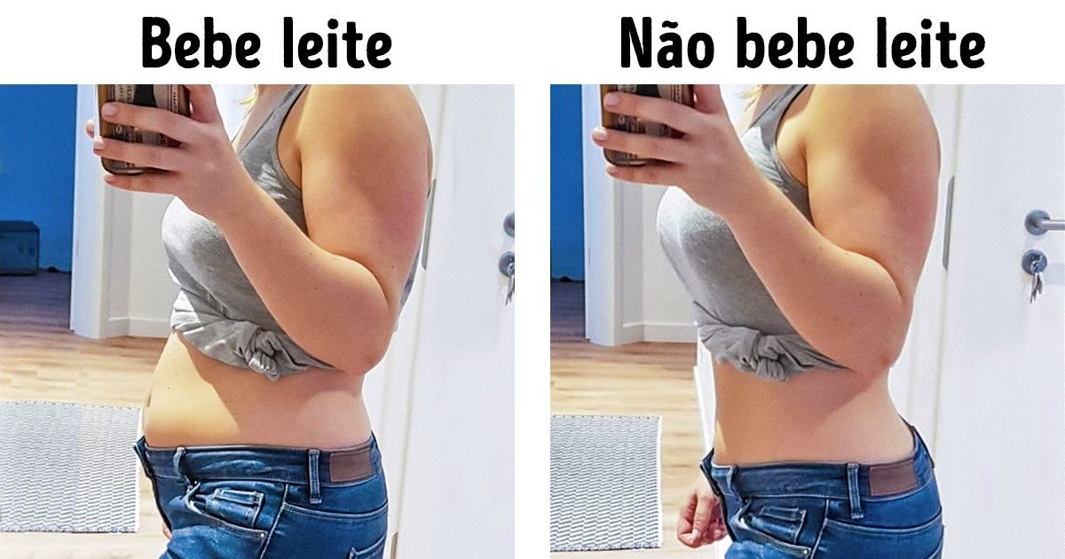 10+ Sinais de que você é intolerante a alguns alimentos comuns