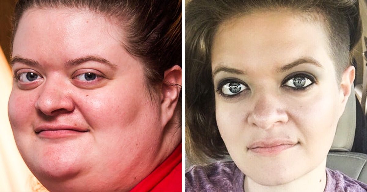 20 Pessoas que deram um basta no excesso de peso