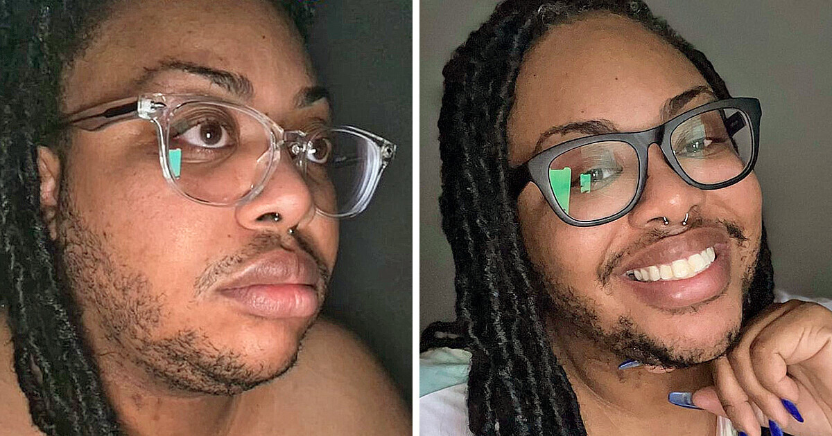 Mulher que se barbeava todos os dias revela o motivo de ter largado a lâmina Mulher que se barbeava todos os dias revela o motivo de ter largado a lâmina