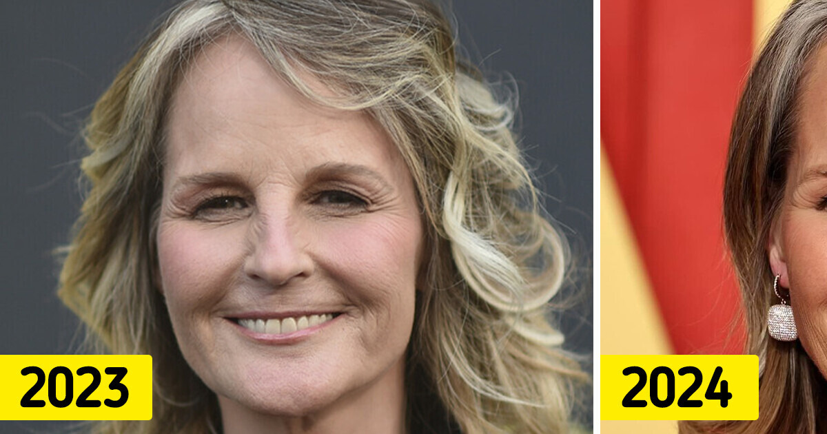 Helen Hunt, 60, surpreende a internet em aparição recente – Internautas falam dos lábios da atriz