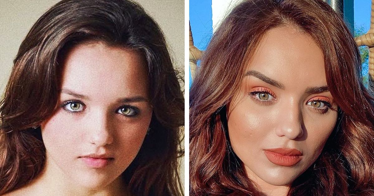 19 Famosos que não hesitam em recorrer à cirurgia para melhorar a aparência 19 Famosos que não hesitam em recorrer à cirurgia para melhorar a aparência