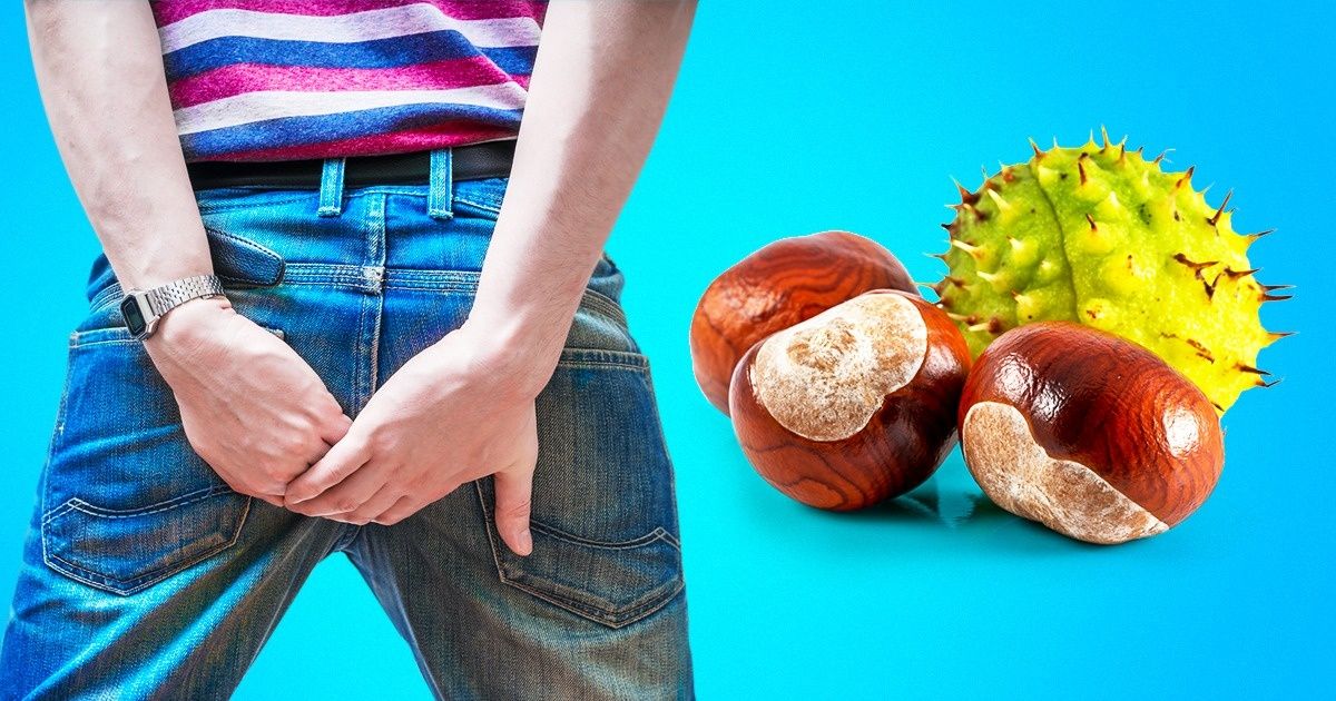 11 Maneiras de eliminar problemas retais sem cirurgia 11 Maneiras de eliminar problemas retais sem cirurgia