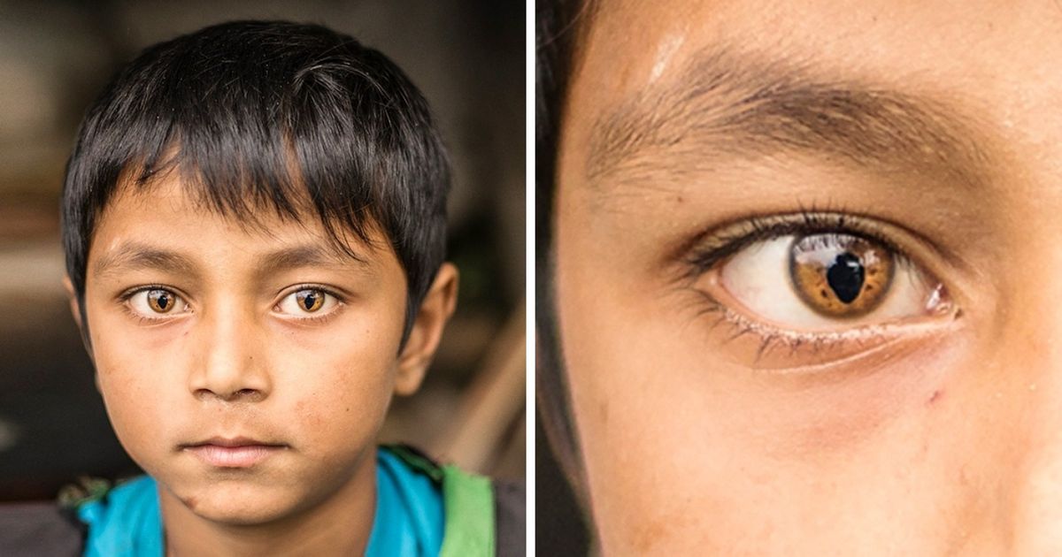 23 Pessoas com características absolutamente marcantes