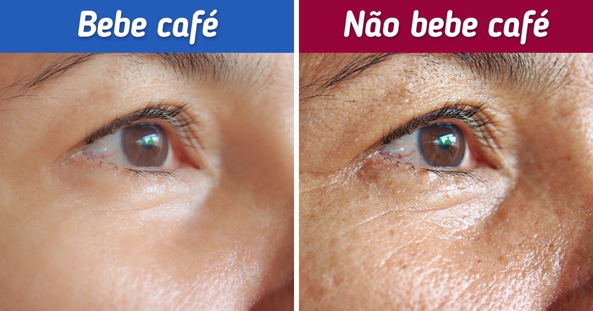 O que pode acontecer com a sua pele se você parar de beber café O que pode acontecer com a sua pele se você parar de beber café