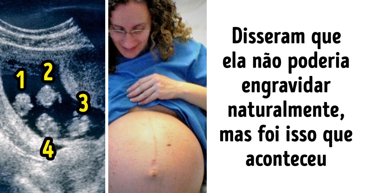Pouco antes de se submeter a fertilização in vitro, mulher fica grávida de quadrigêmeos