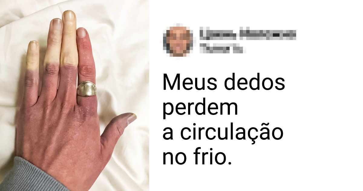 15 Pessoas cujos traços únicos são inesquecíveis 15 Pessoas cujos traços únicos são inesquecíveis