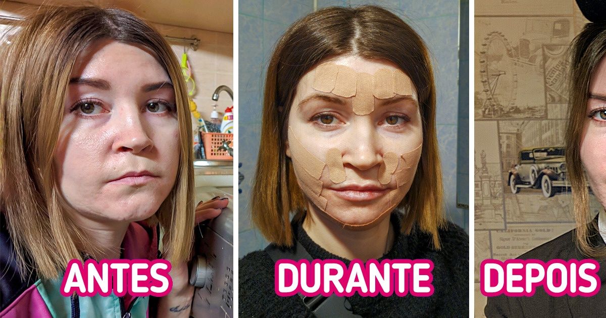 15 Pessoas que se submeteram a procedimentos estéticos contam suas experiências