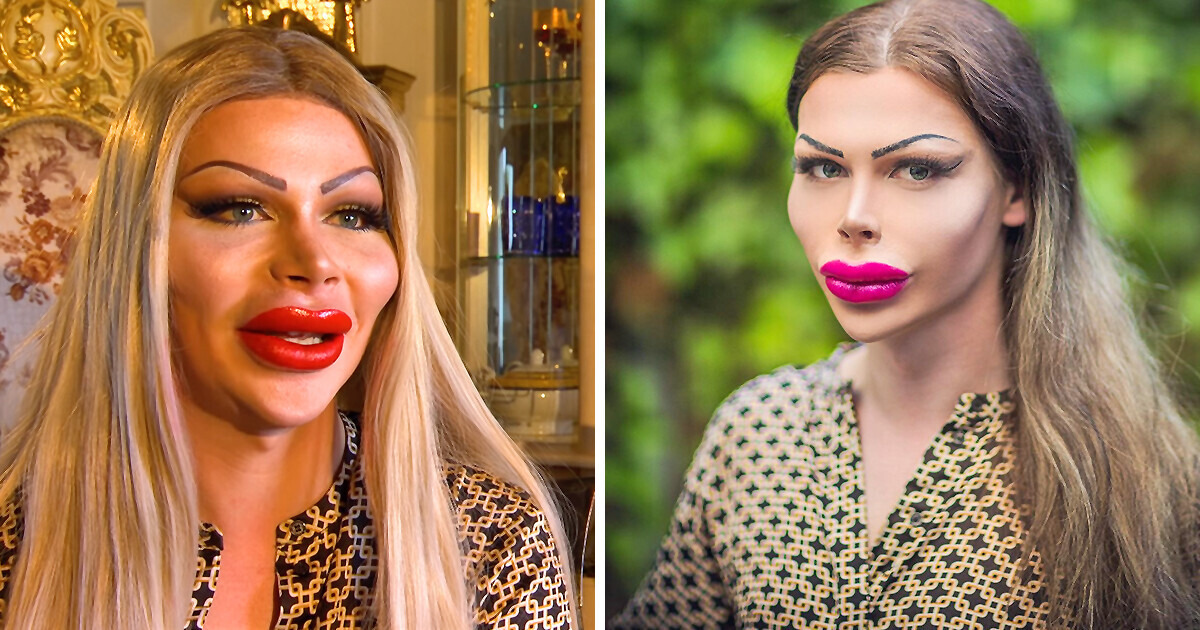 Jovem já gastou uma fortuna em cirurgia plástica desde os 18 anos e não pretende parar Jovem já gastou uma fortuna em cirurgia plástica desde os 18 anos e não pretende parar