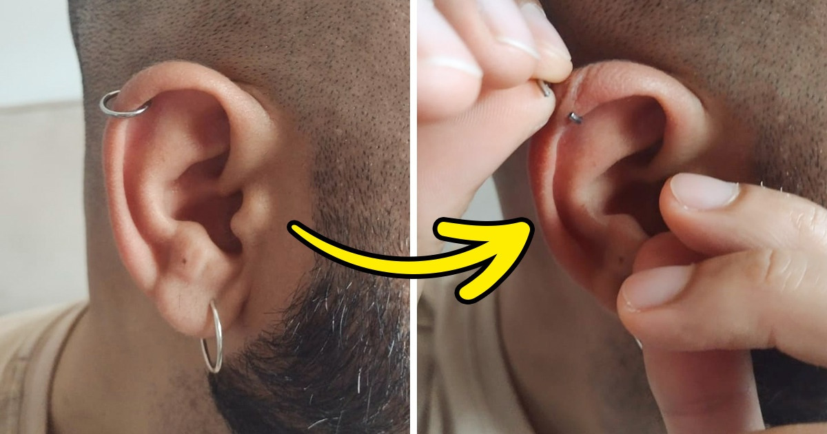 Dúvida Frequente: Porque é necessário tirar piercings do rosto para fazer  raio x?