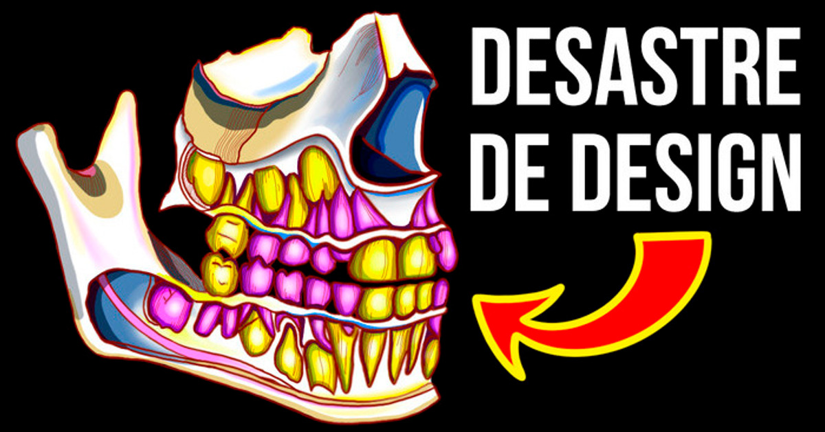 Por Que Você Precisa de Aparelho nos Dentes, Mas Seu Cachorro Não
