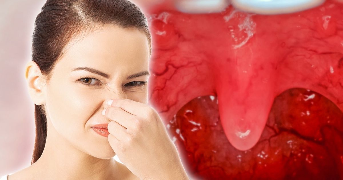 12 Dicas para acabar de vez com o drama do mau hálito 12 Dicas para acabar de vez com o drama do mau hálito