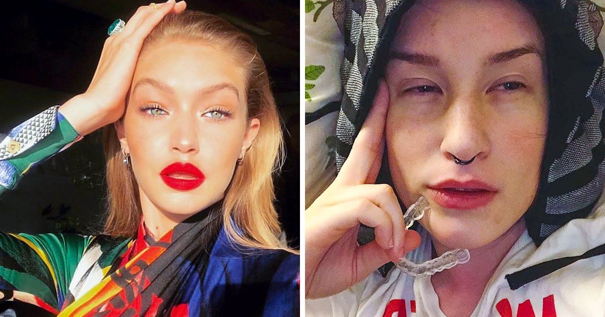 Uma nova tendência de beleza aborreceu milhares de pessoas e dividiu os usuários da Internet