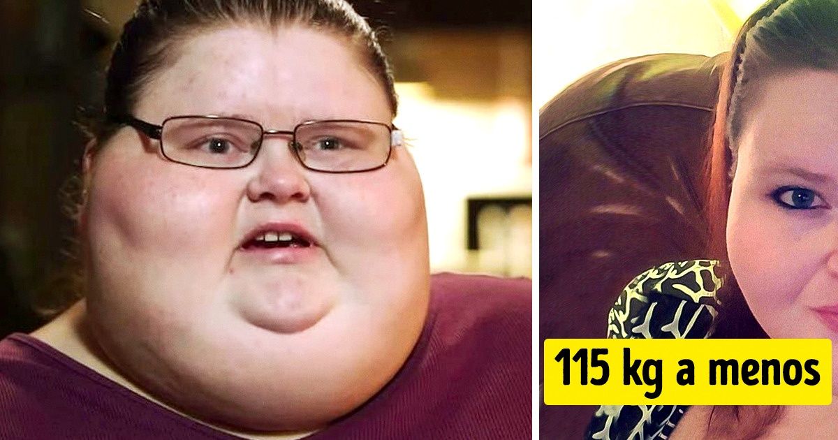 12 Pessoas que mudaram radicalmente em apenas 1 ano 12 Pessoas que mudaram radicalmente em apenas 1 ano