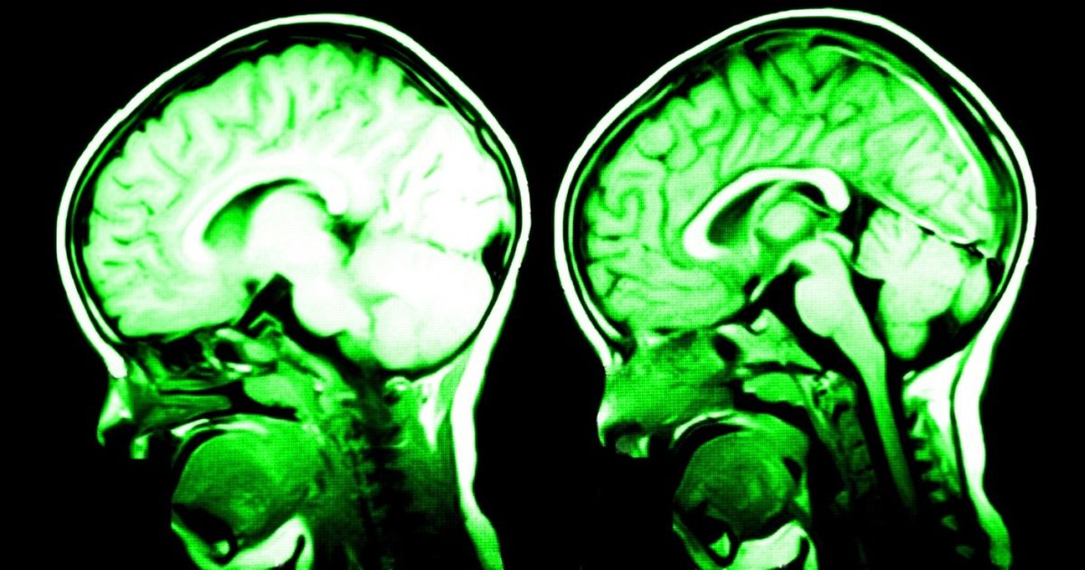7 Maneiras de fazer o seu cérebro funcionar melhor