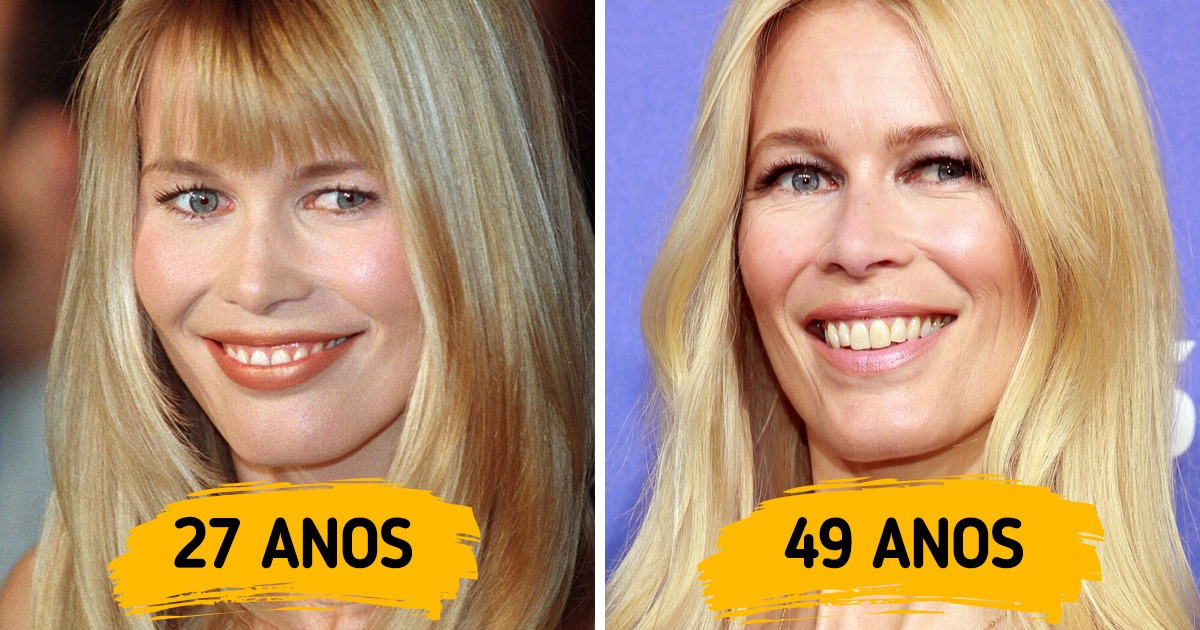 15 Celebridades que não se importam com lifting e botox e se permitiram ser elas mesmas