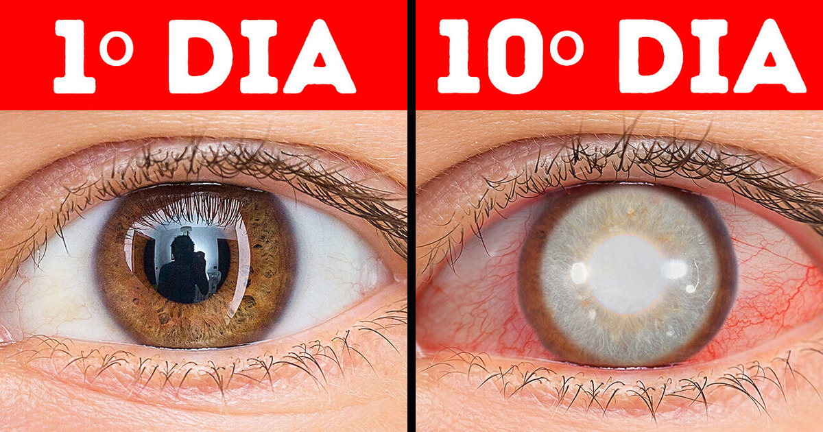 O que acontece se você não piscar O que acontece se você não piscar