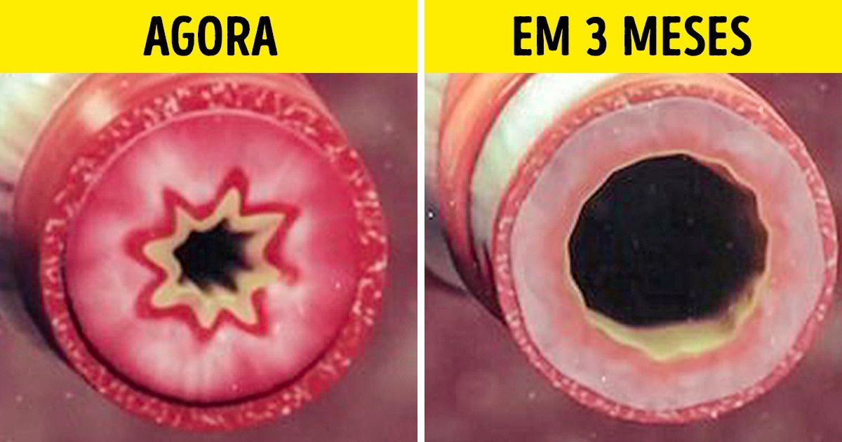 20 Truques que ajudam a deixar de fumar e evitar a recaída 20 Truques que ajudam a deixar de fumar e evitar a recaída