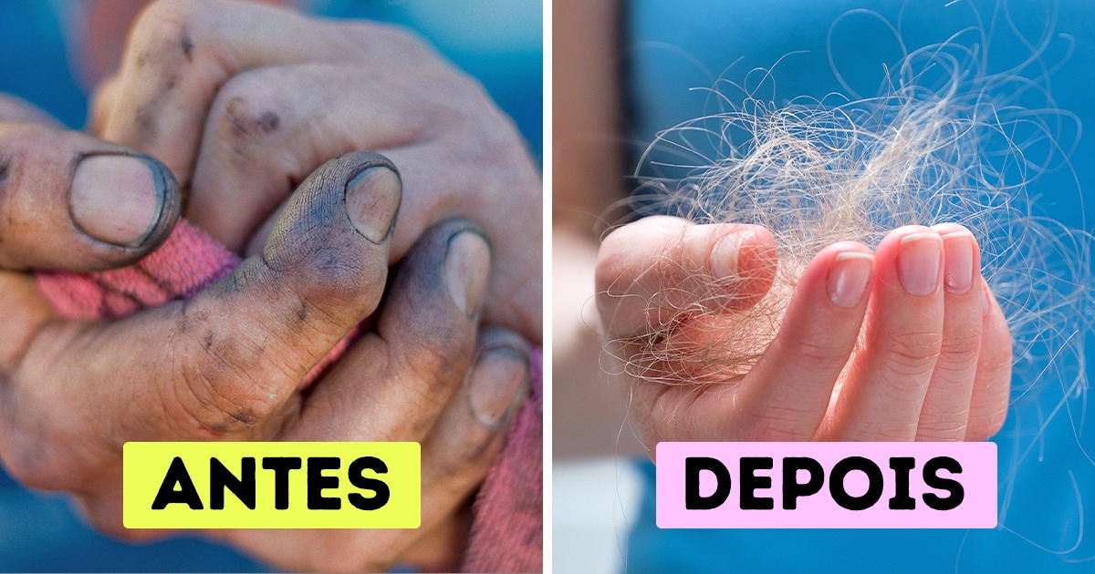 Por que não deveríamos usar a mesma toalha por mais de 2 dias seguidos Por que não deveríamos usar a mesma toalha por mais de 2 dias seguidos