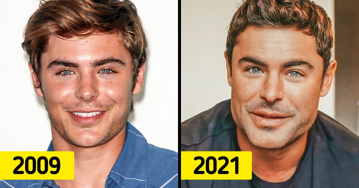 Zac Efron aparece com rosto diferente e fãs o comparam com