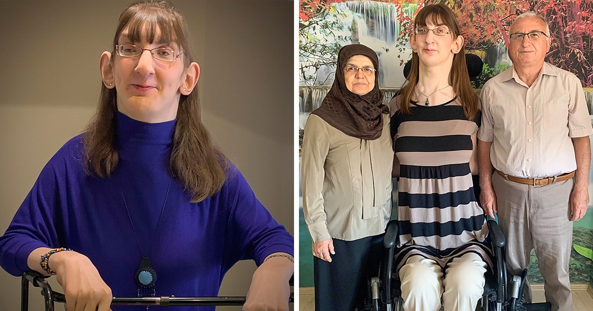 Conheça Rumeysa Gelgi, a mulher de 25 anos mais alta do mundo Conheça Rumeysa Gelgi, a mulher de 25 anos mais alta do mundo