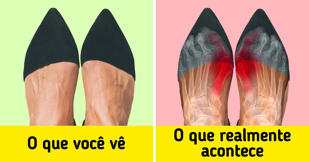 8 Costumes do cotidiano que são realmente prejudiciais