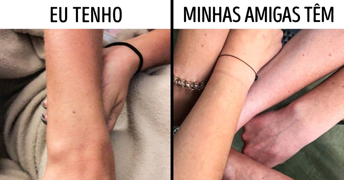 Tuíte inesperado revela que quase todas as mulheres têm um sinal no mesmo lugar Tuíte inesperado revela que quase todas as mulheres têm um sinal no mesmo lugar