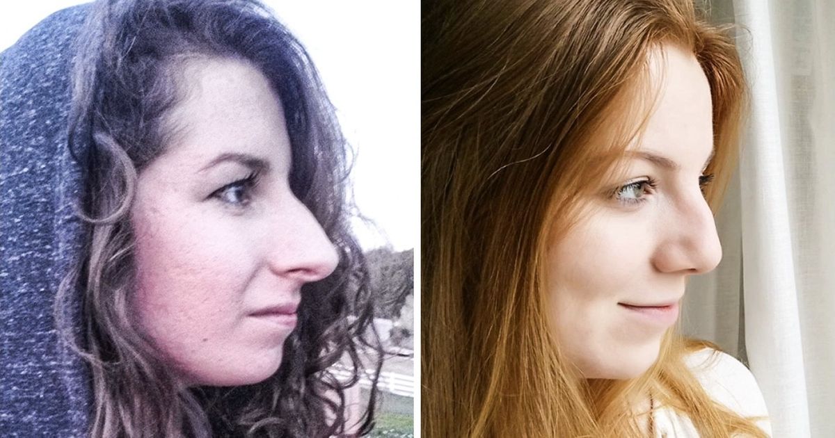 Você já mediu seu nariz? Após fazer isso, algumas pessoas se viram por outro ângulo Você já mediu seu nariz? Após fazer isso, algumas pessoas se viram por outro ângulo